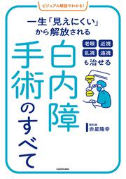 ビジュアル解説でわかる！ 老眼 近視 乱視 遠視も治せる 白内障手術のすべて 一生「見えにくい」から解放される